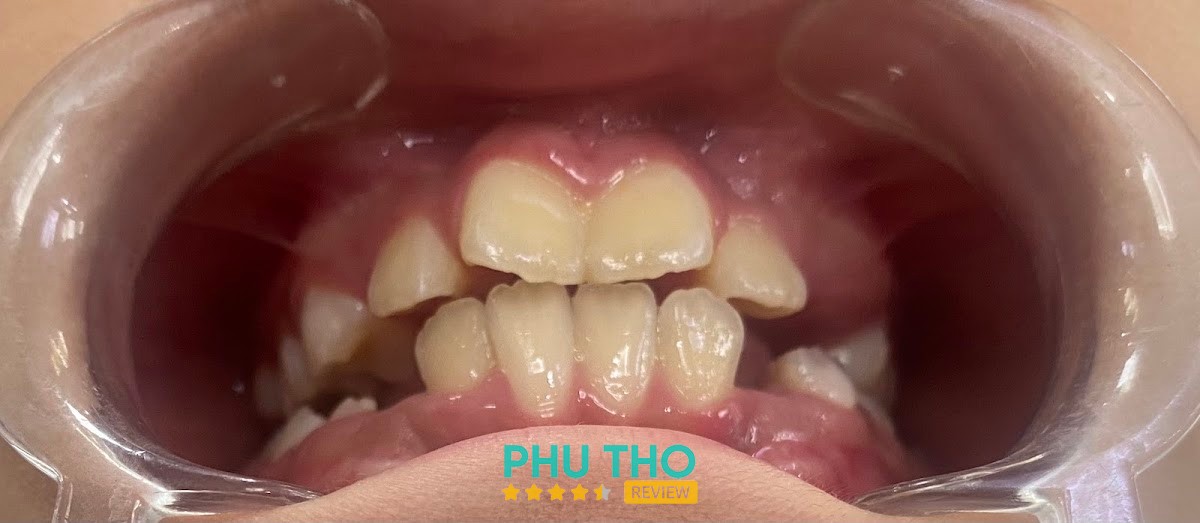 Nha Khoa Nhật Nam – hình ảnh 2
