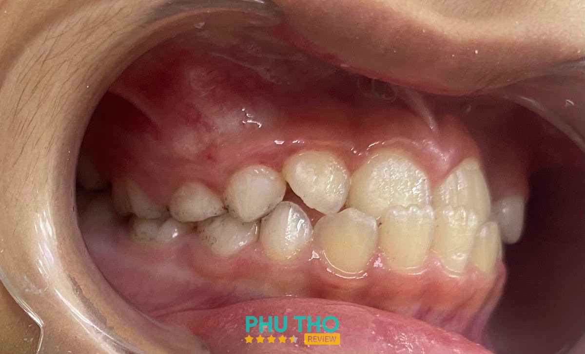 Nha Khoa Nhật Nam – hình ảnh 3