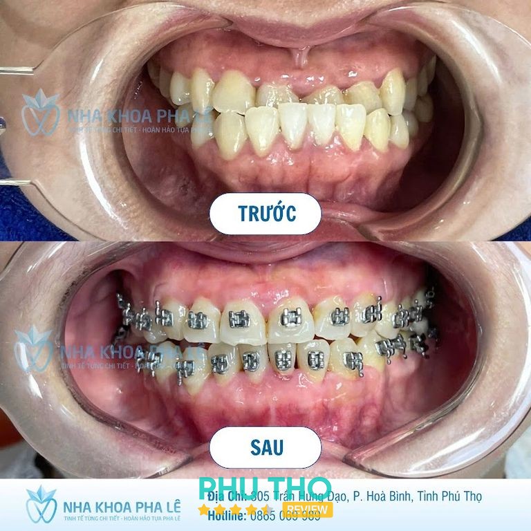Nha khoa Pha Lê Bác sĩ Huyền hình ảnh 2