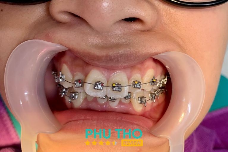 Nha khoa Bách Khoa Smile hình ảnh 3