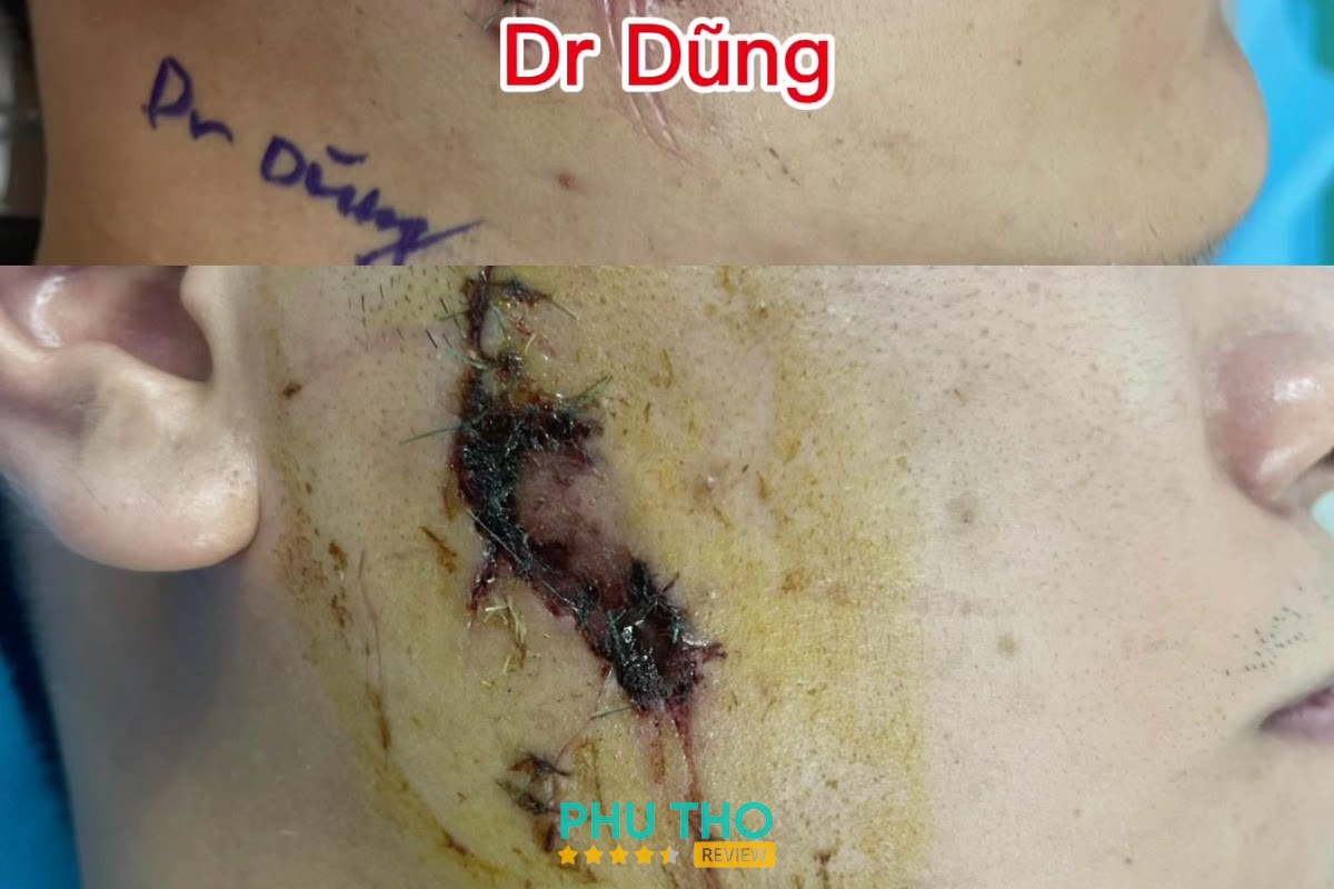 Thạc sĩ, bác sĩ Anh Tuấn Khoa Cơ Xương Khớp