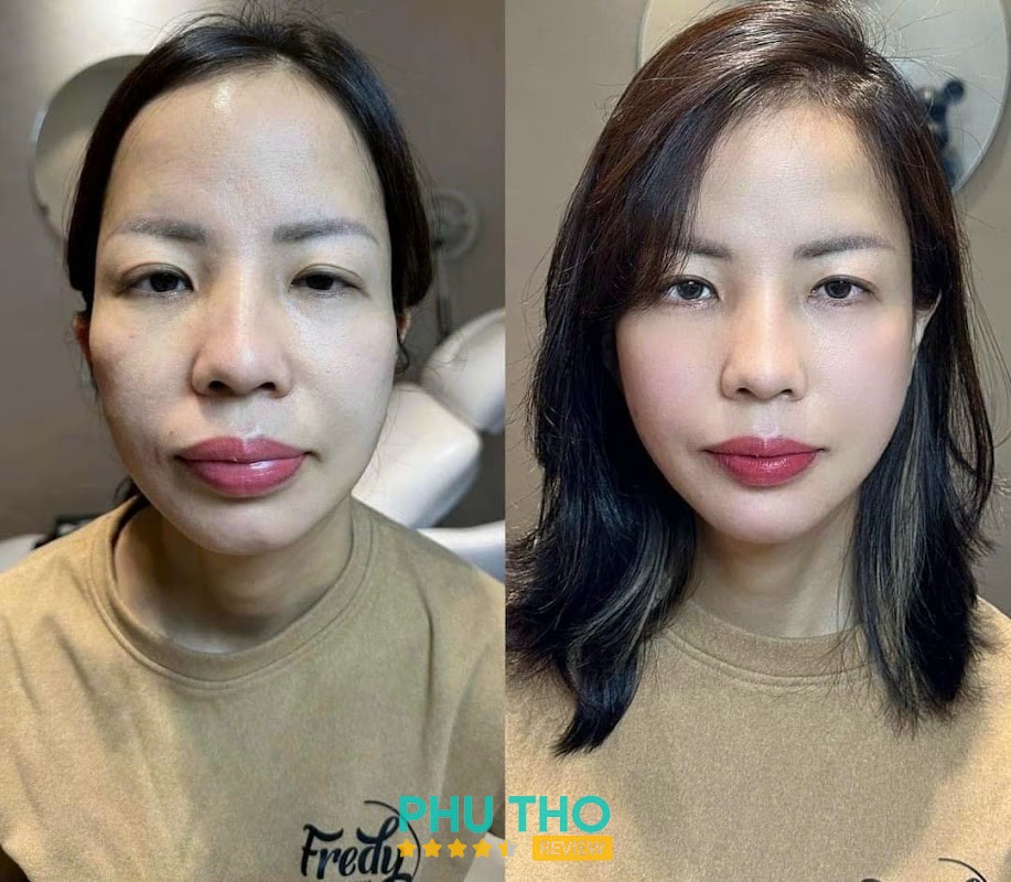 Phòng khám Da liễu Việt Đức - Việt Trì – hình ảnh 3
