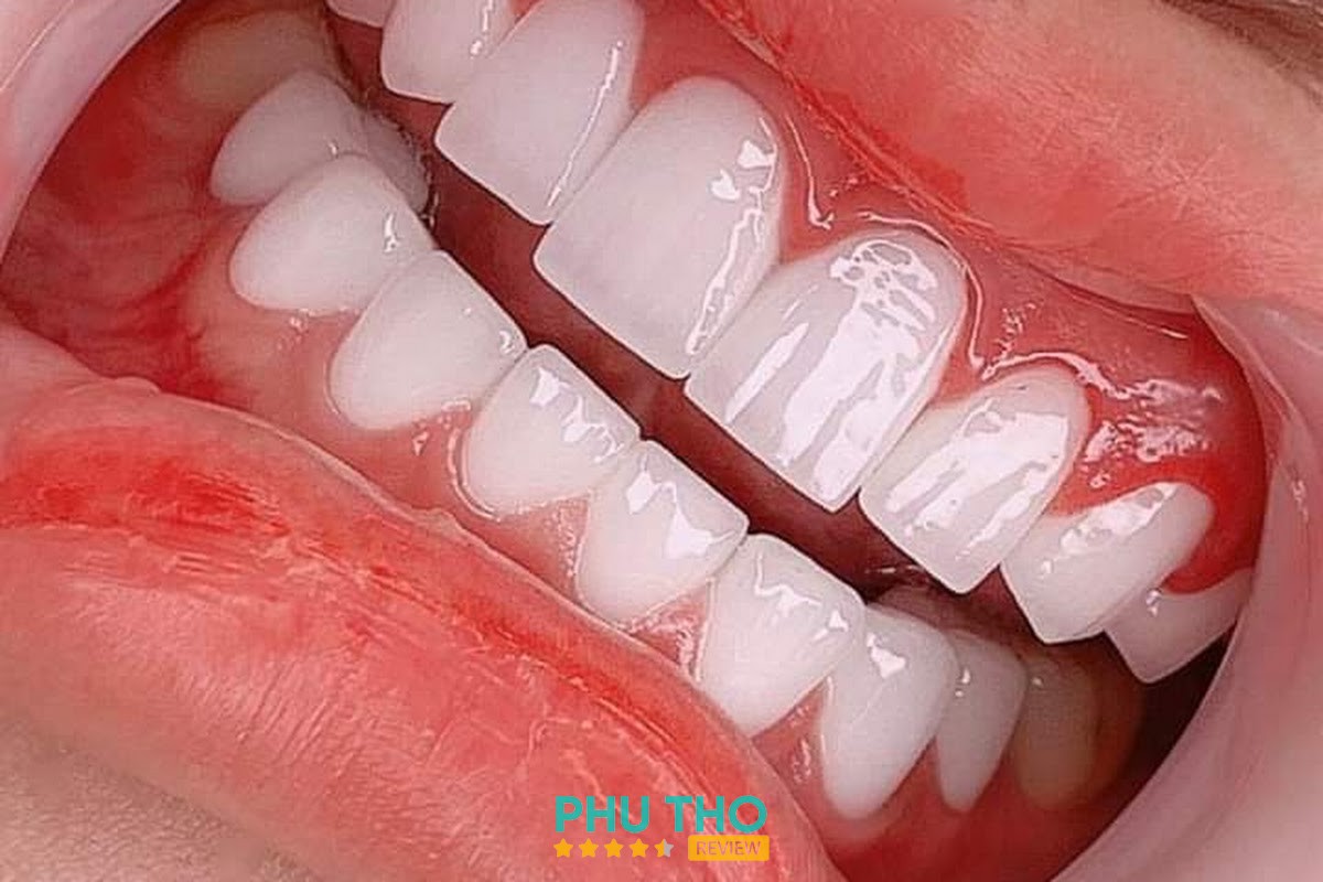 Phòng Khám Nha Khoa Việt Long tại Thanh Miếu