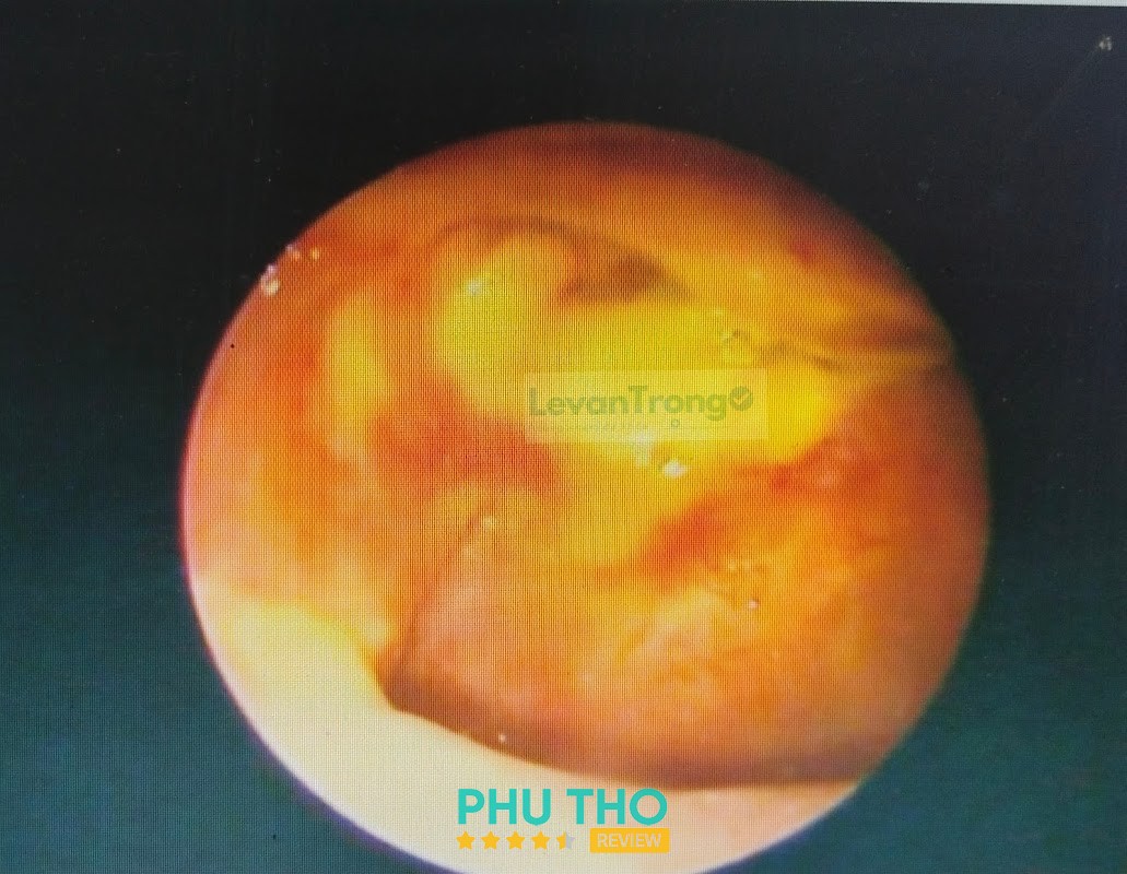 Phòng khám chuyên khoa Tai Mũi Họng thôn Kim Đê hình ảnh 3
