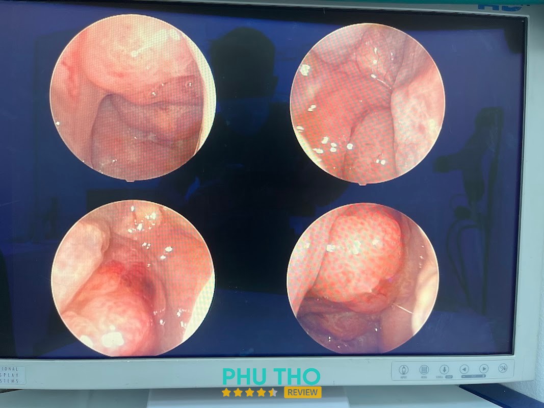 Phòng khám Tai Mũi Họng Bs Phát Phú Thọ