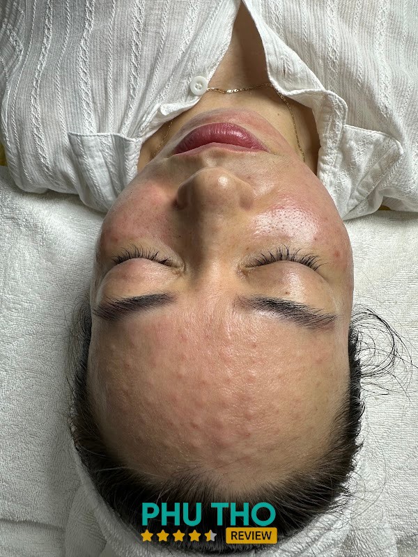PHÒNG KHÁM CK DA LIỄU VÀ SPA THIÊN HƯƠNG – hình ảnh 3