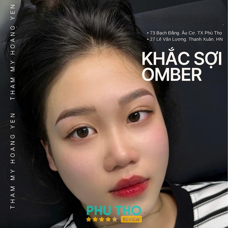 Thẩm Mỹ Hoàng Yến Phú Thọ – hình ảnh 3